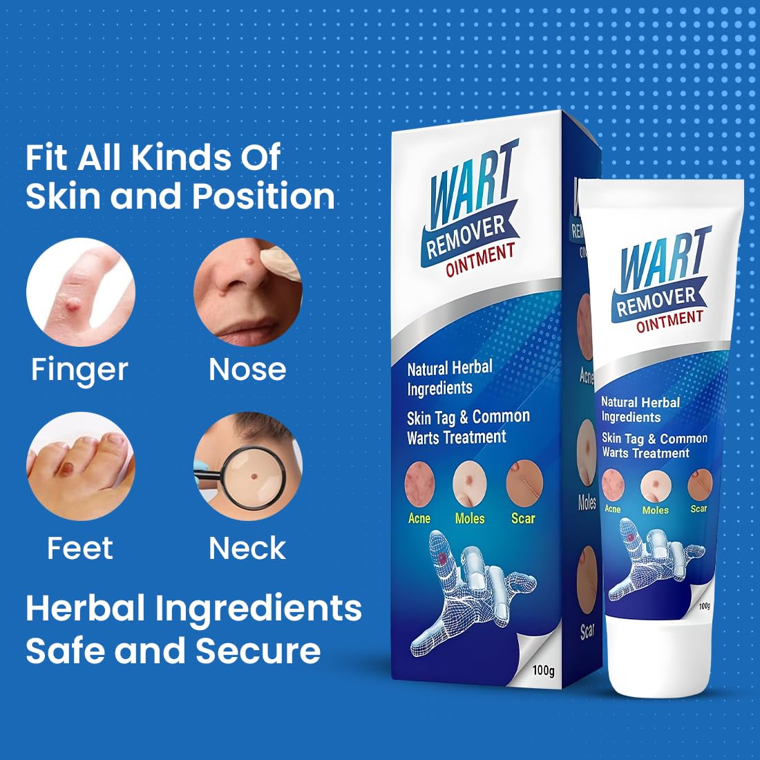 Wart Remover (Pack of 1)